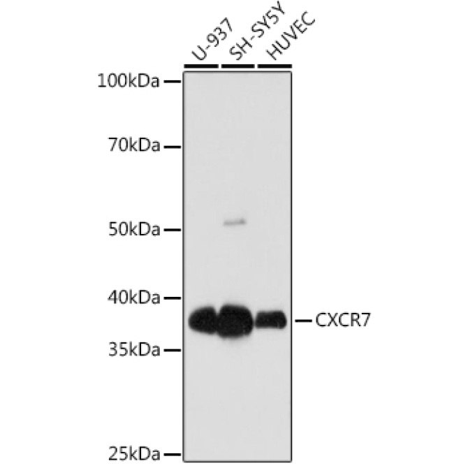 CXCR7 Rabbit Monoclonal Antibody
