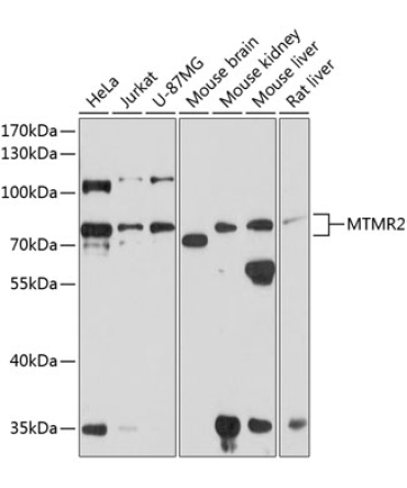 MTMR2 Rabbit Polyclonal Antibody