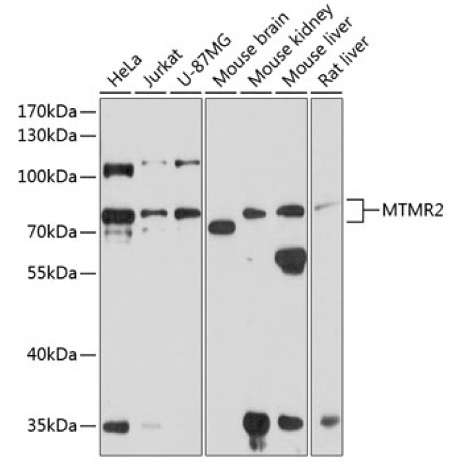 MTMR2 Rabbit Polyclonal Antibody