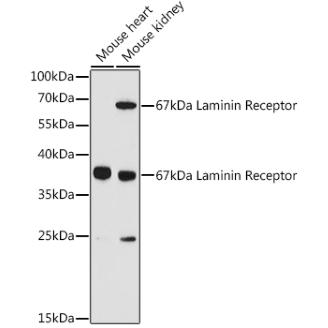 67kDa Laminin Receptor Rabbit Polyclonal Antibody