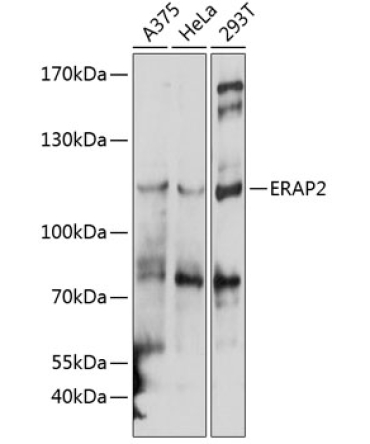 ERAP2 Rabbit Polyclonal Antibody