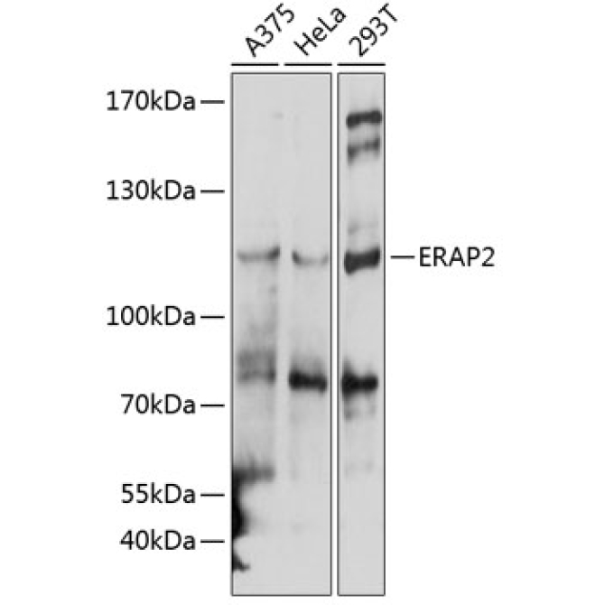 ERAP2 Rabbit Polyclonal Antibody