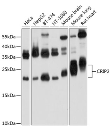 CRIP2 Rabbit Polyclonal Antibody