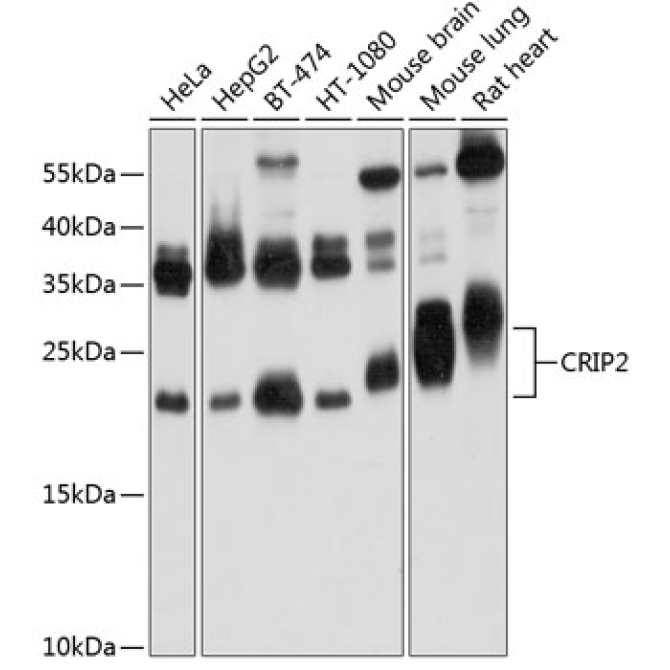 CRIP2 Rabbit Polyclonal Antibody