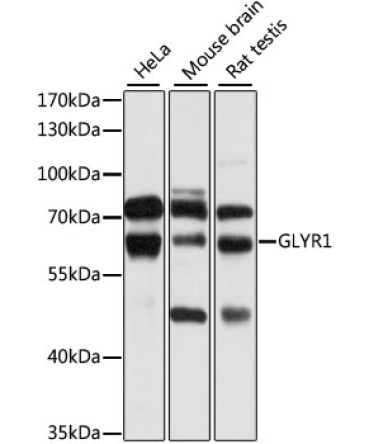 GLYR1 Rabbit Polyclonal Antibody