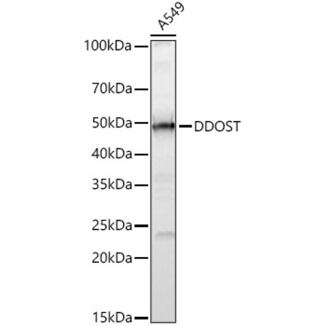 DDOST Rabbit Polyclonal Antibody