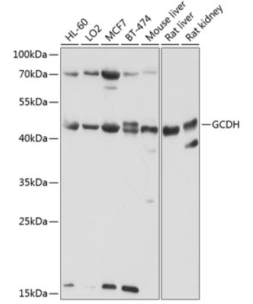 GCDH Rabbit Polyclonal Antibody