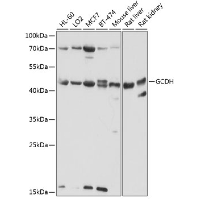 GCDH Rabbit Polyclonal Antibody