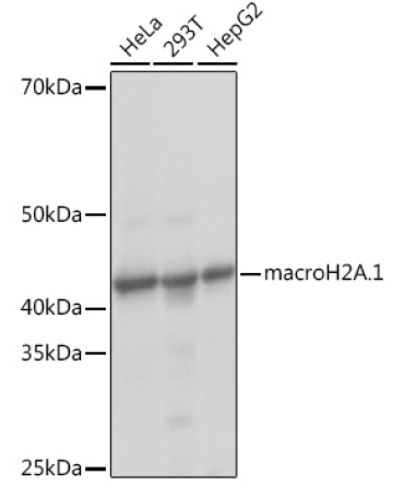 macroH2A.1 Rabbit Monoclonal Antibody