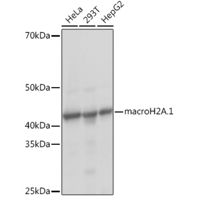 macroH2A.1 Rabbit Monoclonal Antibody
