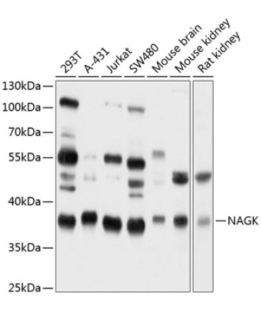 NAGK Rabbit Polyclonal Antibody