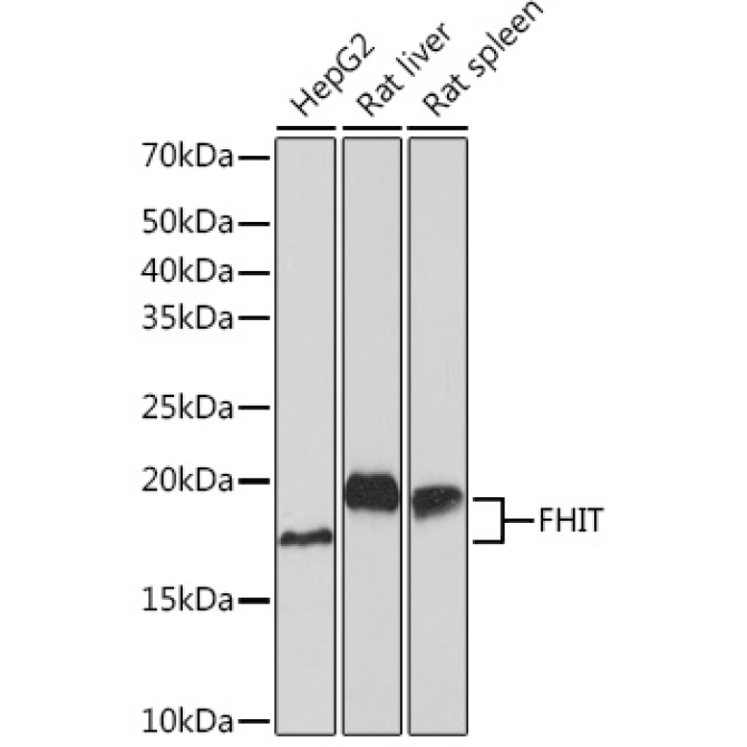 FHIT Rabbit Monoclonal Antibody