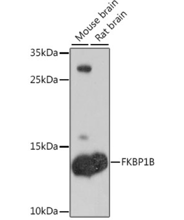 FKBP1B Rabbit Polyclonal Antibody