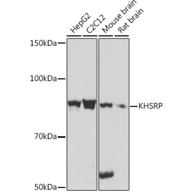 KHSRP Rabbit Monoclonal Antibody