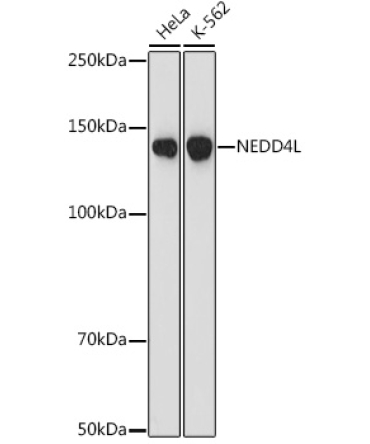 NEDD4L Rabbit Monoclonal Antibody