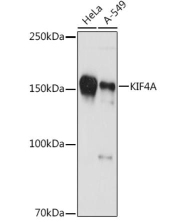 KIF4A Rabbit Monoclonal Antibody