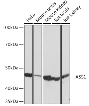 ASS1 Rabbit Monoclonal Antibody