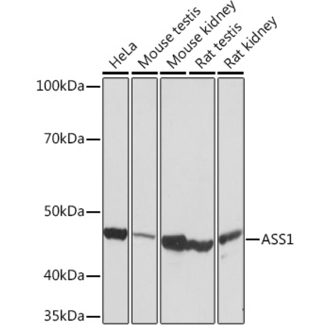 ASS1 Rabbit Monoclonal Antibody