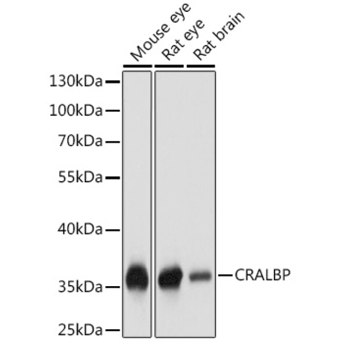 CRALBP Rabbit Polyclonal Antibody
