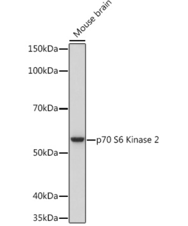 p70 S6 Kinase 2 Rabbit Monoclonal Antibody