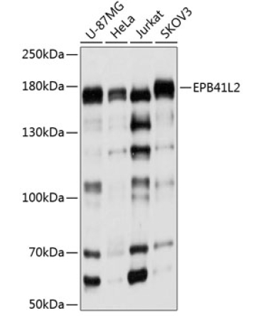EPB41L2 Rabbit Polyclonal Antibody