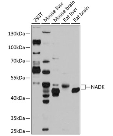 NADK Rabbit Polyclonal Antibody