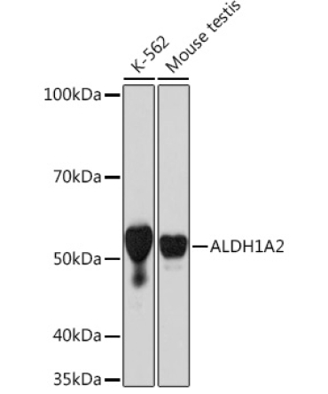 ALDH1A2 Rabbit Monoclonal Antibody