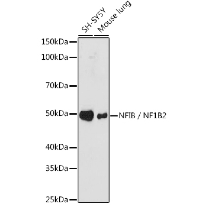 NFIB / NF1B2 Rabbit Monoclonal Antibody