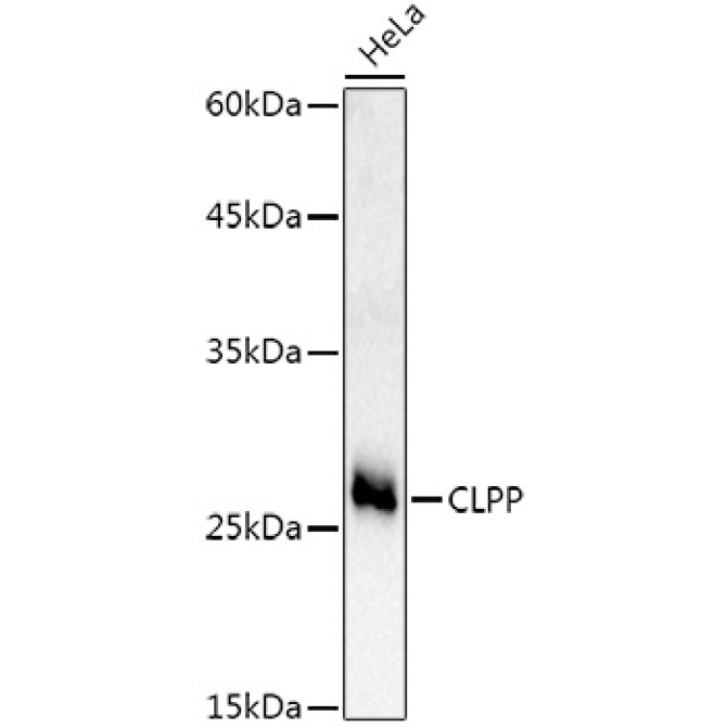 CLPP Rabbit Polyclonal Antibody