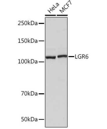 LGR6 Rabbit Monoclonal Antibody