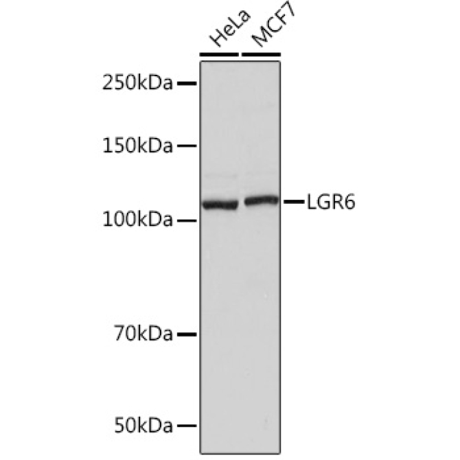 LGR6 Rabbit Monoclonal Antibody