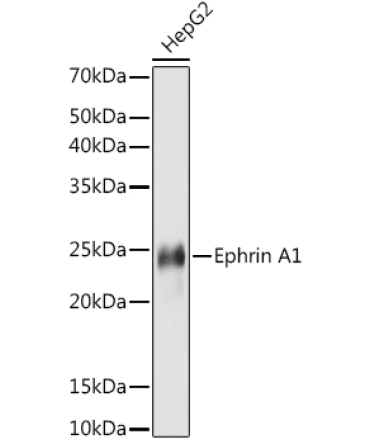 Ephrin A1 Rabbit Monoclonal Antibody