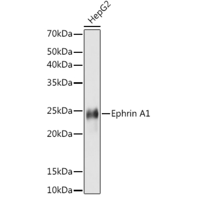 Ephrin A1 Rabbit Monoclonal Antibody