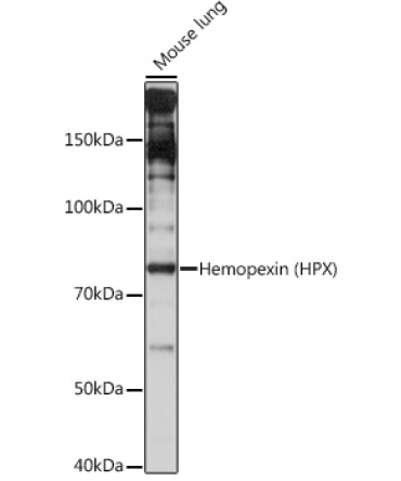 Hemopexin (HPX) Rabbit Monoclonal Antibody