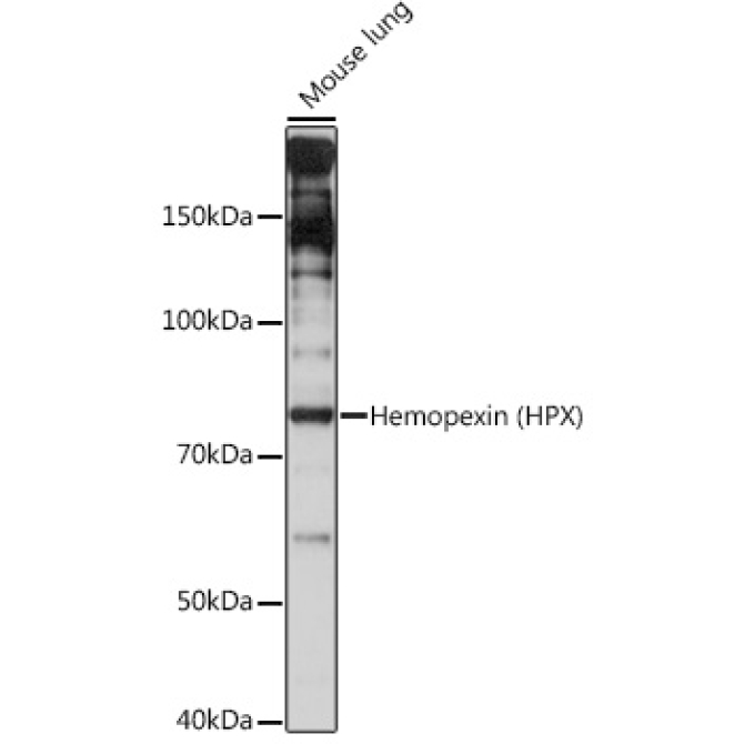Hemopexin (HPX) Rabbit Monoclonal Antibody