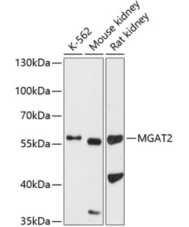 MGAT2 Rabbit Polyclonal Antibody