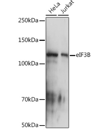 eIF3B Rabbit Monoclonal Antibody
