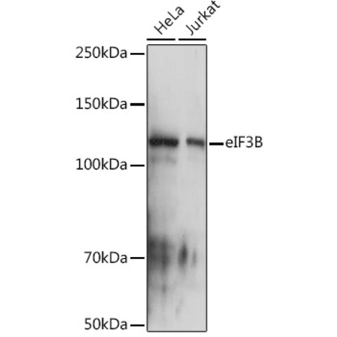 eIF3B Rabbit Monoclonal Antibody