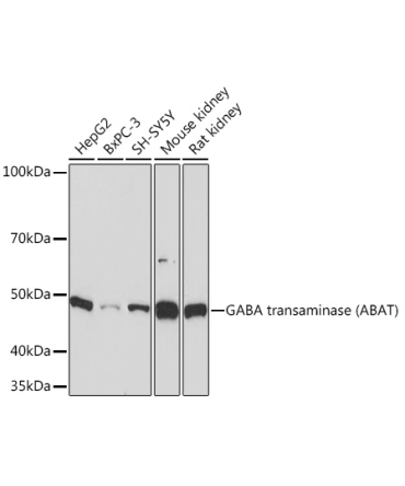 GABA transaminase (ABAT) Rabbit Monoclonal Antibody