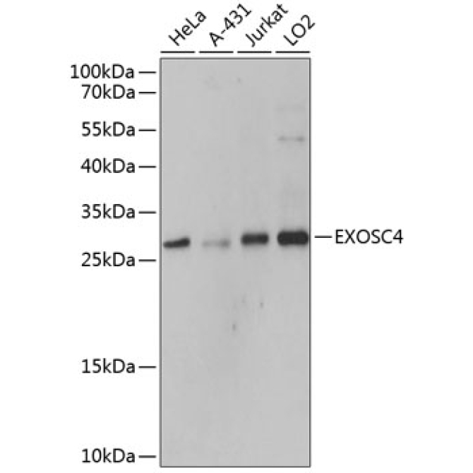 EXOSC4 Rabbit Polyclonal Antibody