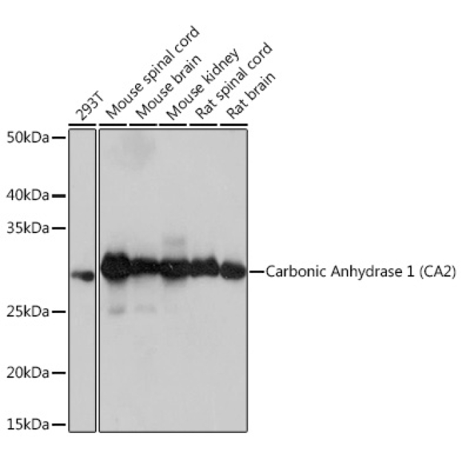 Carbonic Anhydrase 2 (CA2) Rabbit Monoclonal Antibody
