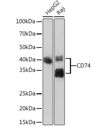 CD74 Rabbit Monoclonal Antibody