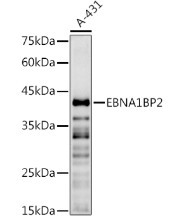 EBNA1BP2 Rabbit Polyclonal Antibody