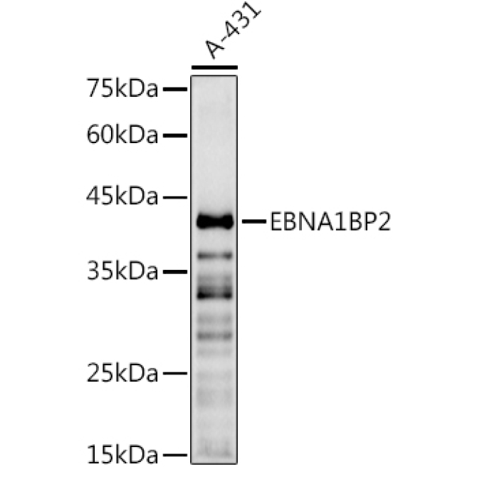 EBNA1BP2 Rabbit Polyclonal Antibody