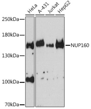 NUP160 Rabbit Polyclonal Antibody