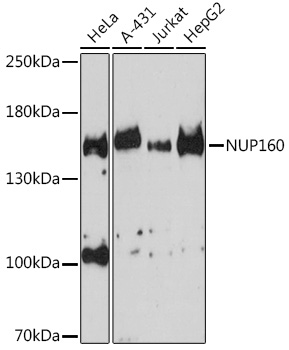 NUP160 Rabbit Polyclonal Antibody