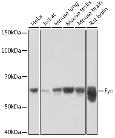 Fyn Rabbit Monoclonal Antibody