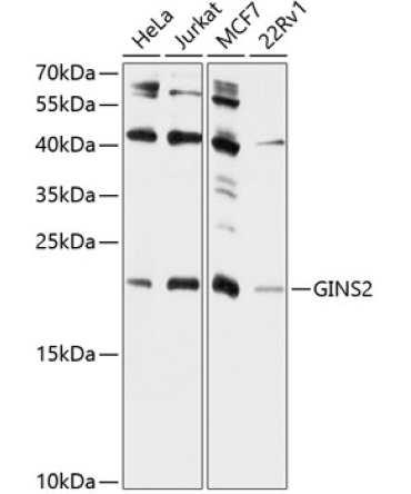 GINS2 Rabbit Polyclonal Antibody