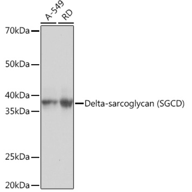 Delta-sarcoglycan (SGCD) Rabbit Monoclonal Antibody