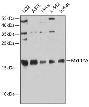 MYL12A Rabbit Polyclonal Antibody